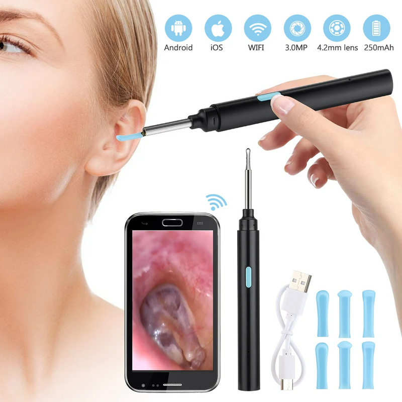 Limpador de Ouvido Inteligente com Câmera e Conexão Sem Fio OtoView Pro®