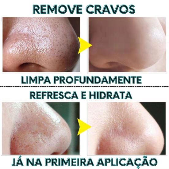 removedor de cravos,removedor de cravos lanbena,lanbena,lanbena removedor de cravos,lanbena cravos,creme removedor de cravos,cravos,removedor de cravos do tiktok,lanbena removedor de cravo,creme removedor de cravos lanbena,o melhor removedor de cravos lanbena,removedor de cravos lanbena resenha,lambena removedor de cravos,resenha máscara removedora de cravos lanbena,máscara de cravos,removedor de cravo,removedor de cravos eficiente