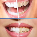 Pó Clareador Dental para Higiene Oral