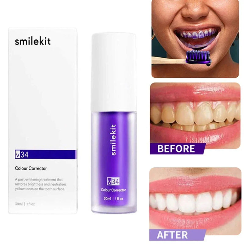 clareador dental,clareamento dental,clareamento dental caseiro,clarear os dentes,como clarear os dentes em casa,clareador,clarear os dentes em casa,clareador dental fácil,carvvo clareador dental,dental,o melhor clareador dental,clareador dental natural,clareador dental da shopee,como clarear os dentes,dentes brancos,clareador de dente,receita para clarear os dentes,carvvo clareador dental natural,caneta clareador de dentes