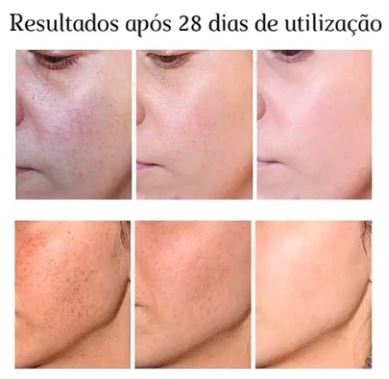 creme clareador de virilha,clareador de virilha e axila,clareador de axilas e virilhas,clarear axilas e virilhas,como clarear axilas e virilhas,clarear virilha,clareador de virilha,clarear axilas,o melhor clareador de virilha,como clarear axila e virilha,como clarear as axilas,como clarear virilha,clarear virilha antes e depois,creme clareador íntimo de axilas e virilhas,clareador de axilas,o melhor clareador de virilha e axilas,clarear as axilas e virilha